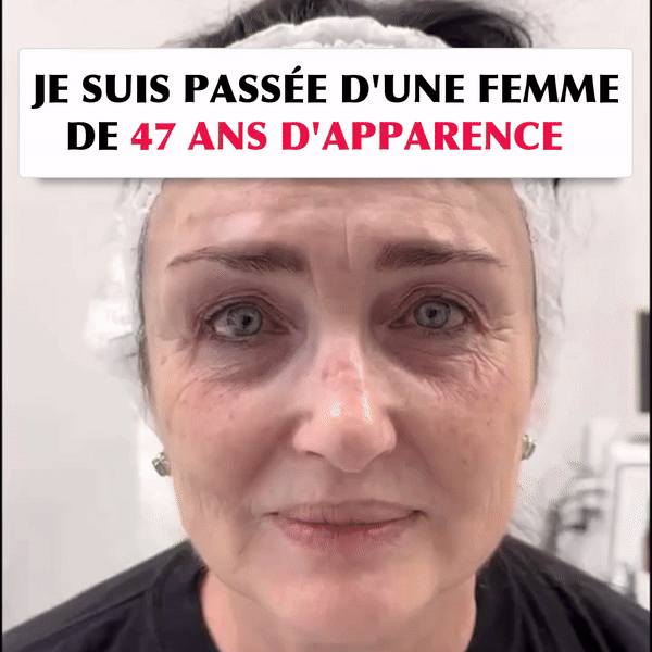 Anti-rides et Anti-cerne numéro 1 au Mali 🇲🇱